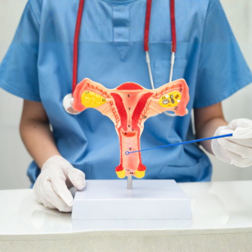 Image-guided uterine fibroid embolization