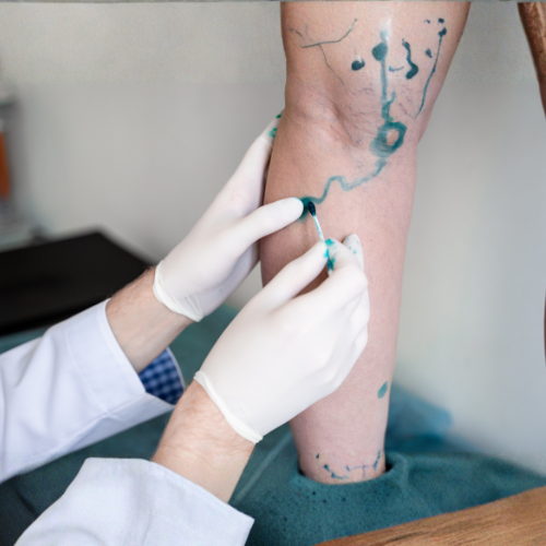 Image Guided Vascular Treatment