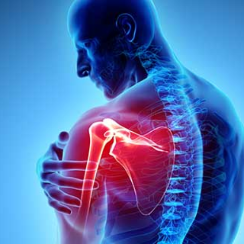 Shoulder osteoarthritis treatment
