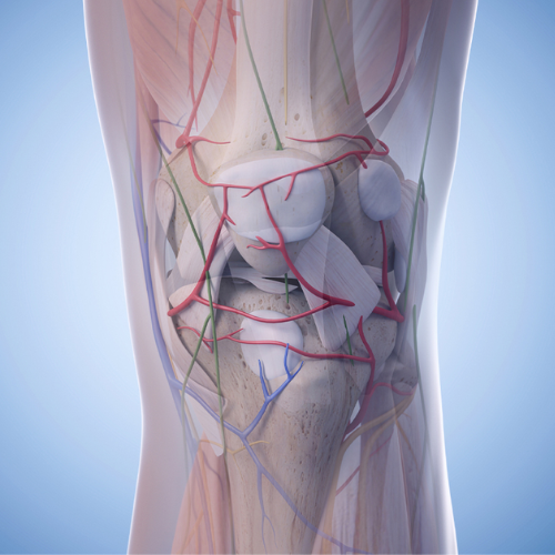 Genicular artery embolisation procedure